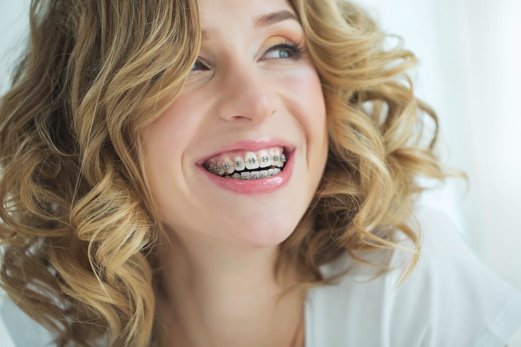 Damon® System Braces Round Rock