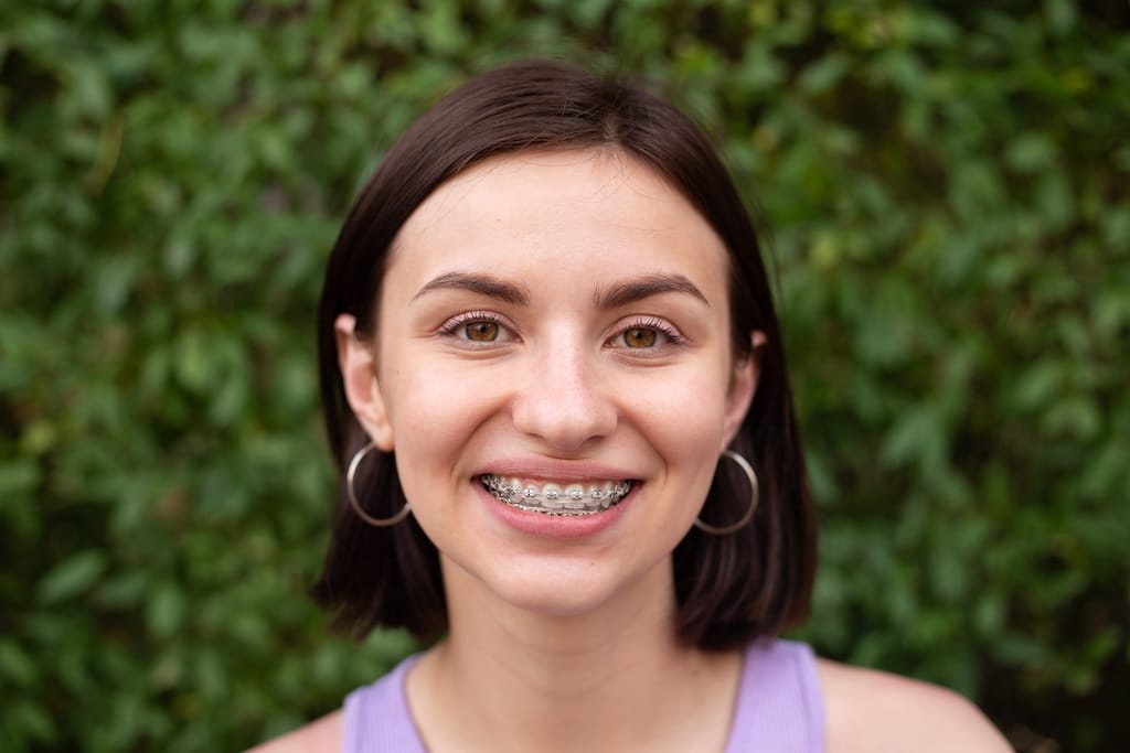Self-ligating braces at Wildflower Orthodontics in Round Rock and Pflugerville